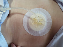 Load image into Gallery viewer, CATH DRESSING® (4” x 4”) - 15 Pieces