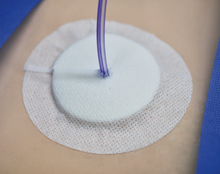 Load image into Gallery viewer, CATH DRESSING® (4” x 4”) - 15 Pieces
